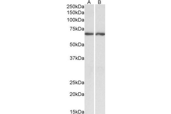 Acetylcholinesterase Antikörper  (C-Term)