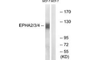 Western blot analysis of extracts from MCF-7 cells, using EPHA2/3/4 (Ab-588/596) Antibody. (EPHA2/3/4 Antikörper  (AA 556-605))