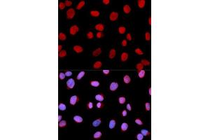 Immunofluorescence (IF) image for anti-Minichromosome Maintenance Complex Component 6 (MCM6) (AA 562-821) antibody (ABIN3022687)