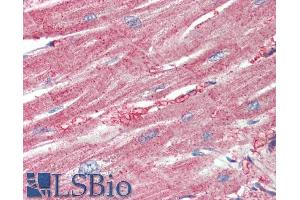 Immunohistochemistry (IHC) image for anti-Actin Related Protein 2/3 Complex, Subunit 1A, 41kDa (ARPC1A) (C-Term) antibody (ABIN5539619)