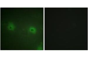 Immunofluorescence analysis of HuvEc cells, using STAM2 (Ab-192) Antibody. (STAM2 Antikörper  (AA 161-210))