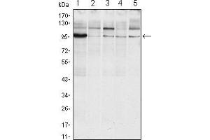 Western blot analysis using ERN1 mouse mAb against Raji (1), A431 (2), Jurkat (3), Hela(4) and HEK293 (5) cell lysate. (ERN1 Antikörper  (AA 282-433))