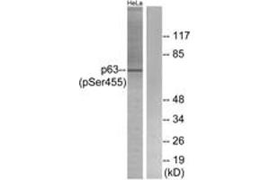 Western blot analysis of extracts from HeLa cells treated with TNF 2500U/ML 30', using p63 (Phospho-Ser455) Antibody. (TCP1 alpha/CCTA Antikörper  (pSer455))