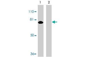 Western blot analysis of MTA2 expression in HeLa whole cell lysates in the absence (lane 1) or presence (lane 2) of blocking peptide with MTA2 polyclonal antibody  at 1 ug /mL . (MTA2 Antikörper  (AA 652-668))