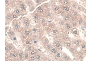 Detection of GAMT in Rat Liver Tissue using Polyclonal Antibody to Guanidinoacetate-N-Methyltransferase (GAMT) (GAMT Antikörper  (AA 2-236))