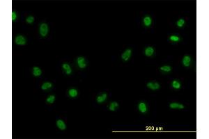 Immunofluorescence of monoclonal antibody to FOXA1 on HeLa cell. (FOXA1 Antikörper  (AA 367-472))