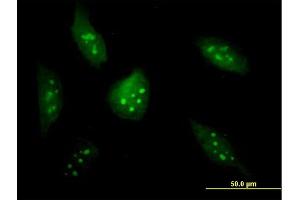 Immunofluorescence of purified MaxPab antibody to BXDC2 on HeLa cell. (BRIX1 Antikörper  (AA 1-353))