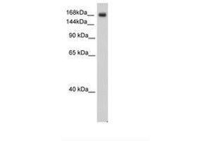 Image no. 2 for anti-Sodium Channel, Voltage-Gated, Type V, alpha Subunit (SCN5A) (AA 1856-1905) antibody (ABIN6736314) (SCN5A Antikörper  (AA 1856-1905))