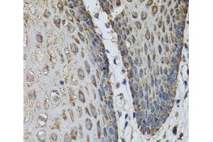 Immunohistochemistry of paraffin-embedded Human esophagus using IL36G Polyclonal Antibody at dilution of 1:100 (40x lens). (IL1F9 Antikörper)