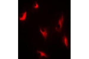 Immunofluorescent analysis of Thymidine Phosphorylase staining in A549 cells. (Thymidine Phosphorylase Antikörper)