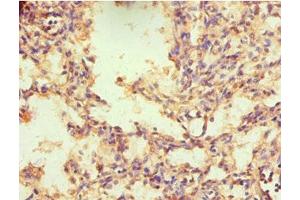 Immunohistochemistry of paraffin-embedded human lung tissue using ABIN7161903 at dilution of 1:100 (NR2C1 Antikörper  (AA 1-240))
