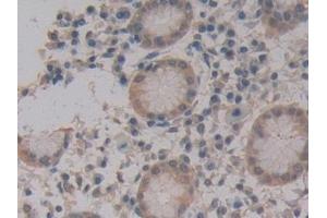 Detection of MPG1 in Human Stomach Tissue using Polyclonal Antibody to Macrophage Expressed Gene 1 Protein (MPG1) (MPEG1 Antikörper  (AA 313-580))