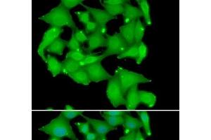 Immunofluorescence analysis of A549 cells using PRKD3 Polyclonal Antibody (PRKD3 Antikörper)