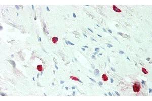 Detection of HA in Human Mast Cells of Colon Tissue using Monoclonal Antibody to Histamine (HA) (Histamine Antikörper)