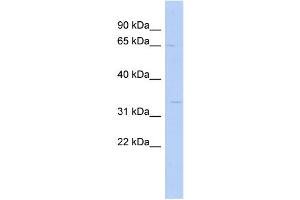 WB Suggested Anti-SC5DL Antibody Titration: 0. (SC5DL Antikörper  (N-Term))