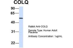 Host:  Rabbit  Target Name:  COLQ  Sample Type:  Human Adult Placenta  Antibody Dilution:  1. (COLQ Antikörper  (N-Term))