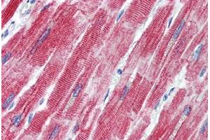 Immunohistochemistry (Paraffin-embedded Sections) (IHC (p)) image for anti-TEA Domain Family Member 1 (SV40 Transcriptional Enhancer Factor) (TEAD1) (C-Term) antibody (ABIN462220)
