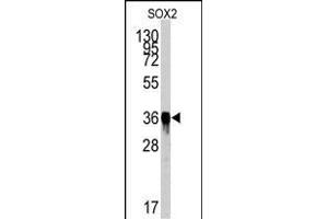 Western blot analysis of SOX2 Antibody (ABIN387798 and ABIN2843854) by SOX2 recombinant protein. (SOX2 Antikörper)