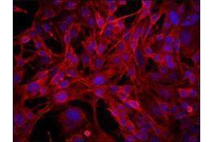 Immunofluorescence (IF) image for anti-CD68 Molecule (CD68) antibody (ABIN2664804) (CD68 Antikörper)