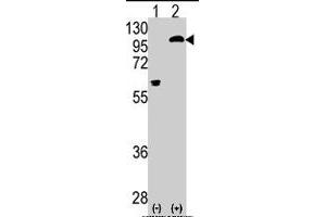 Western blot analysis of PRKCE (arrow) using rabbit PRKCE polyclonal antibody . (PKC epsilon Antikörper  (AA 213-243))