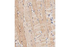 Immunohistochemistry (Paraffin-embedded Sections) (IHC (p)) image for anti-CXADR-Like Membrane Protein (CLMP) (AA 81-110) antibody (ABIN656961)