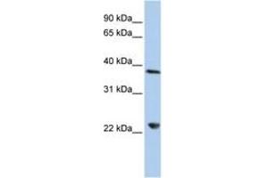 Image no. 1 for anti-DEAD (Asp-Glu-Ala-Asp) Box Polypeptide 25 (DDX25) (AA 180-229) antibody (ABIN6742679) (DDX25 Antikörper  (AA 180-229))
