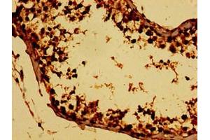 Immunohistochemistry of paraffin-embedded human testis tissue using ABIN7165146 at dilution of 1:100 (BTG4 Antikörper  (AA 1-206))