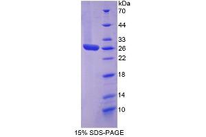 SDS-PAGE (SDS) image for Signal Transducer and Activator of Transcription 3 (Acute-Phase Response Factor) (STAT3) (AA 335-546) protein (His tag) (ABIN4988833)