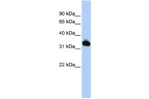 Western Blotting (WB) image for anti-Galactose Mutarotase (Aldose 1-Epimerase) (GALM) antibody (ABIN2459553) (GALM Antikörper)