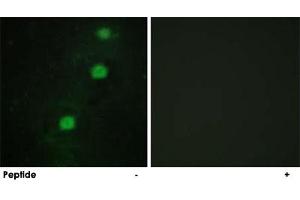 Immunofluorescence analysis of HUVEC cells, using CDK20 polyclonal antibody .
