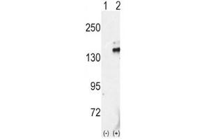 Western blot analysis of RET antibody and 293 cell lysate either nontransfected (Lane 1) or transiently transfected with the RET gene (2).