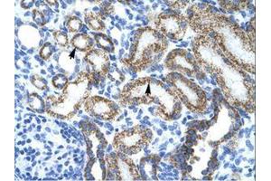 Image no. 1 for anti-Protein L-Myc (MYCL) (AA 135-184) antibody (ABIN202065) (LMYC Antikörper  (AA 135-184))