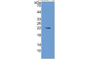 WB of Protein Standard: different control antibodies  against Highly purified E. (IL1A ELISA Kit)