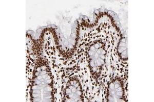 Immunohistochemical staining of human colon with FBXO18 polyclonal antibody  shows strong nuclear positivity in glandular cells at 1:200-1:500 dilution. (FBXO18 Antikörper)