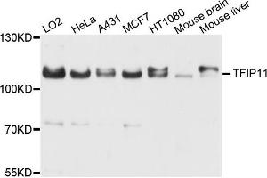 Western blot analysis of extract of various cells, using TFIP11 antibody.