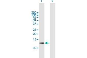 Western Blot analysis of ZSWIM7 expression in transfected 293T cell line by ZSWIM7 MaxPab polyclonal antibody. (ZSWIM7 Antikörper  (AA 1-140))