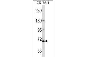 ZN Antibody (N-term ) (ABIN657582 and ABIN2846585) western blot analysis in ZR-75-1 cell line lysates (35 μg/lane). (ZNF135 Antikörper  (N-Term))