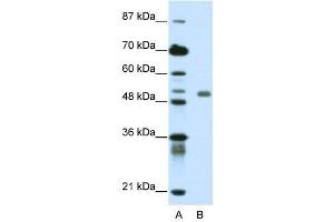 WB Suggested Anti-DEAF1  Antibody Titration: 0. (DEAF1 Antikörper  (C-Term))
