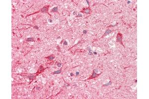 Anti-NF-L / NEFL antibody IHC staining of human brain, cortex. (NEFL Antikörper)