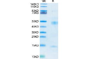 Mouse Latent TGF beta 1 on Tris-Bis PAGE under reduced condition. (Latent TGF-beta 1 protein (His tag))