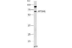 Human AFP lysates probed with Mouse Anti-AFP (A4) Monoclonal Antibody, Unconjugated (bsm-1622M) at 1:300 overnight at 4˚C. (alpha Fetoprotein Antikörper)