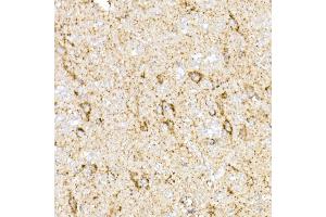 anti-Malate Dehydrogenase 2, NAD (Mitochondrial) (MDH2) antibody