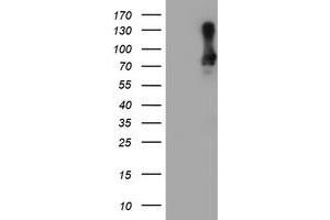 Western Blotting (WB) image for anti-SAM Domain and HD Domain 1 (SAMHD1) antibody (ABIN1500798) (SAMHD1 Antikörper)
