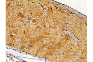 ABIN6257147 and ABIN6274445 at 1/100 staining Rat skin tissue by IHC-P. (DOK4 Antikörper  (N-Term))