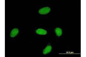 Immunofluorescence of monoclonal antibody to YAP1 on HeLa cell. (YAP1 Antikörper  (AA 53-161))