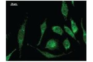 Immunostaining analysis in HeLa cells. (MOB2 Antikörper)