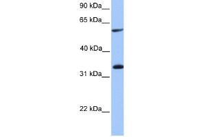 WB Suggested Anti-TSKS Antibody Titration: 0. (TSKS Antikörper  (Middle Region))