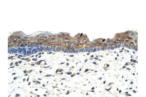 ApoBEC2 antibody was used for immunohistochemistry at a concentration of 4-8 ug/ml to stain Squamous epithelial cells (arrows) in Human Skin. (APOBEC2 Antikörper  (N-Term))