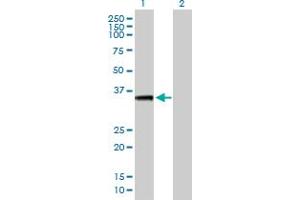 Western Blot analysis of AKTIP expression in transfected 293T cell line by AKTIP MaxPab polyclonal antibody. (AKTIP Antikörper  (AA 1-292))