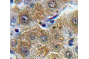 Used in DAB staining on fromalin fixed paraffin-embedded Liver tissue (ORM1 Antikörper  (AA 19-201))